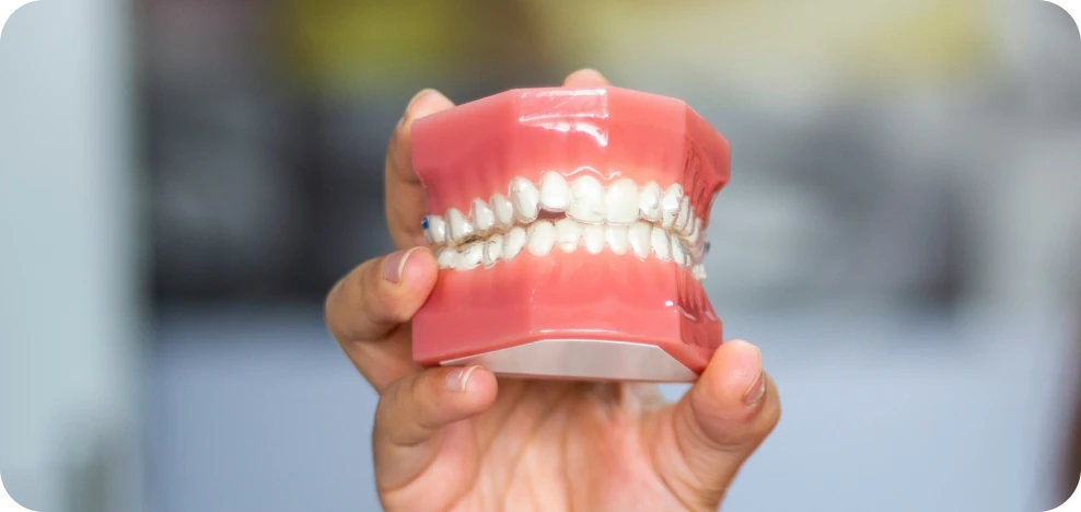 aligneurs adolescent orthodontiste pont audemer