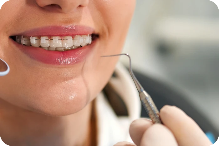 Examen dentaire d'und adolescentd portant un appareil orthodontique