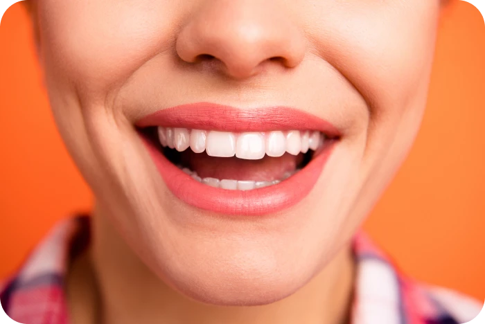 Sourire aligné après traitement orthodontique