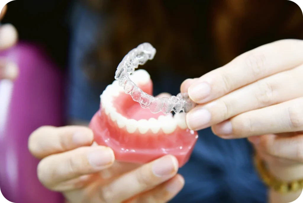 Aligneur transparent présenté sur un modèle dentaire