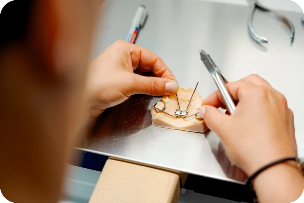 Fabrication d’un disjoncteur orthodontique au laboratoire